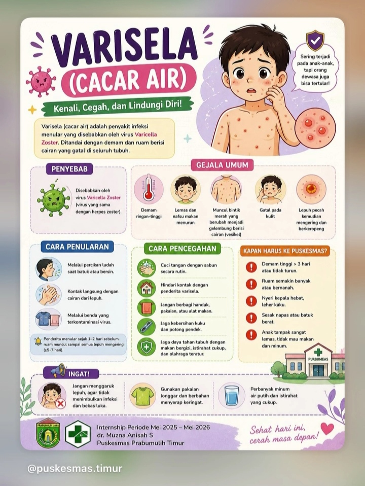 VARICELA (Cacar Air)